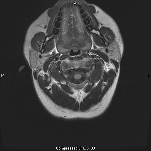 MRI Album 4 Pic 1